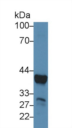 Polyclonal Antibody to Arginase (ARG)