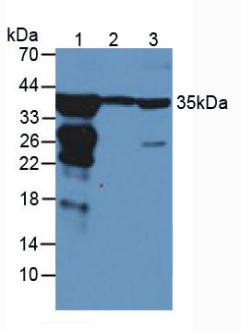 Polyclonal Antibody to Arginase (ARG)