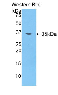 Polyclonal Antibody to Chondroitin Sulfate Proteoglycan 4 (CSPG4)