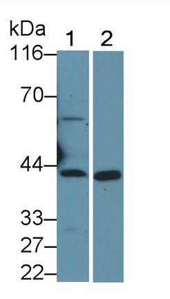 Polyclonal Antibody to Phospholipase A1 (PLA1)