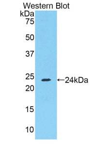 Polyclonal Antibody to Fibrinogen Alpha Chain (FGA)
