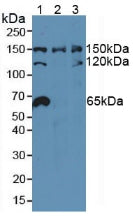 Polyclonal Antibody to Nucleoporin 155 (NUP155)