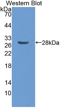 Polyclonal Antibody to Cluster Of Differentiation 1e (CD1e)