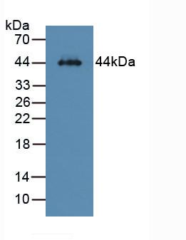 Polyclonal Antibody to Asialoglycoprotein Receptor 1 (ASGR1)
