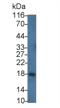 Polyclonal Antibody to Lysozyme (LZM)