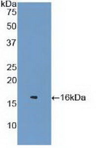 Polyclonal Antibody to Lysozyme (LZM)