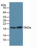 Polyclonal Antibody to Mitogen Activated Protein Kinase 14 (MAPK14)