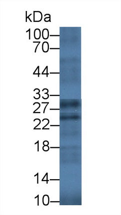 Polyclonal Antibody to Granzyme K (GZMK)