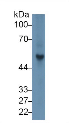 Polyclonal Antibody to Fibrinogen Beta Chain (FGB)
