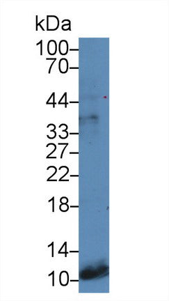 Polyclonal Antibody to Gastrin (GT)