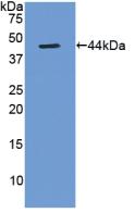 Polyclonal Antibody to Gastrin (GT)