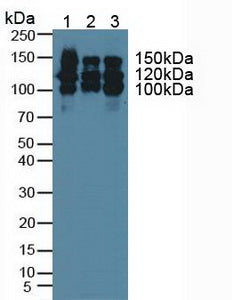 Polyclonal Antibody to Cluster Of Differentiation 56 (CD56)