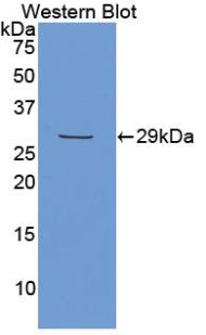 Polyclonal Antibody to Matrix Extracellular Phosphoglycoprotein (MEPE)