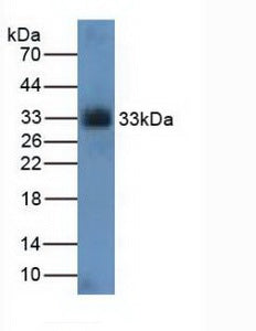 Polyclonal Antibody to Cyclin Dependent Kinase 4 (CDK4)