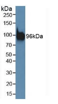 Polyclonal Antibody to Programmed Cell Death Protein 6 Interacting Protein (PDCD6IP)