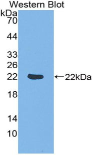 Polyclonal Antibody to Down Regulator Of Transcription 1, TBP Binding (DR1)