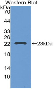 Polyclonal Antibody to Glucagon (GCG)