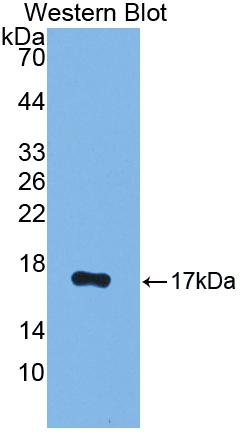 Polyclonal Antibody to Progesterone Receptor (PGR)