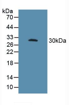 Polyclonal Antibody to Fc Fragment Of IgG Low Affinity IIIa Receptor (FcgR3A)