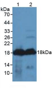 Polyclonal Antibody to Agouti Related Protein (AGRP)