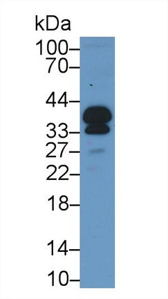 Polyclonal Antibody to Proopiomelanocortin (POMC)