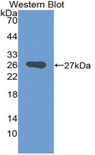 Polyclonal Antibody to Growth Associated Protein 43 (GAP43)