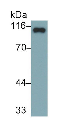 Polyclonal Antibody to Involucrin (INV)