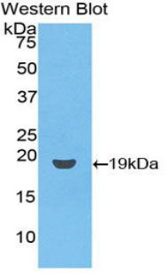 Polyclonal Antibody to Cluster of Differentiation 59 (CD59)