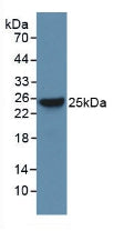 Polyclonal Antibody to Bcl2 Associated X Protein (Bax)