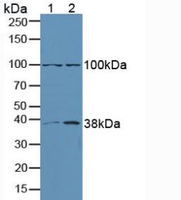 Polyclonal Antibody to Extracellular Signal Regulated Kinase 1 (ERK1)
