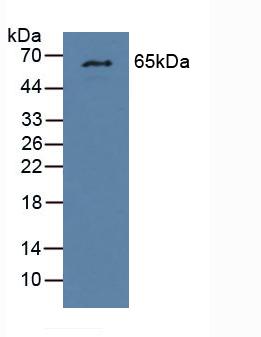 Polyclonal Antibody to Glucokinase Regulatory Protein (GKRP)
