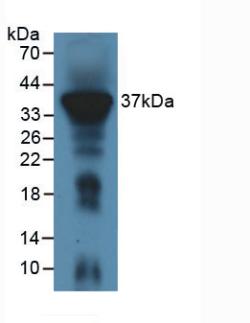 Polyclonal Antibody to Immune Receptor Expressed On Myeloid Cells 1 (IREM1)