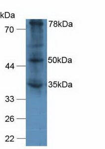 Polyclonal Antibody to Von Willebrand Factor A Domain Containing Protein 2 (vWA2)