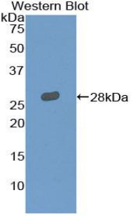 Polyclonal Antibody to Leukocyte Immunoglobulin Like Receptor Subfamily A, Member 2 (LILRA2)
