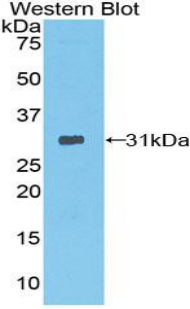 Polyclonal Antibody to Protease, Serine 12 (PRSS12)