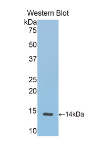 Polyclonal Antibody to Hemoglobin (HB)