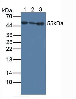 Polyclonal Antibody to Interferon Alpha/Beta Receptor 1 (IFNa/bR1)