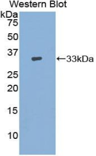 Polyclonal Antibody to Adenylate Cyclase 9 (ADCY9)