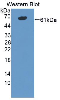 Polyclonal Antibody to Immunoglobulin Superfamily, Member 2 (IGSF2)