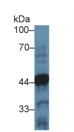 Polyclonal Antibody to Tyrosine Hydroxylase (TH)