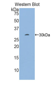 Polyclonal Antibody to Early Growth Response Protein 2 (EGR2)