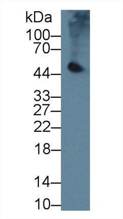 Polyclonal Antibody to Pancreatic Lipase (PL)