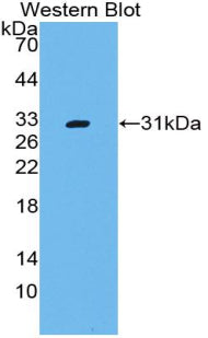 Polyclonal Antibody to Cluster Of Differentiation 109 (CD109)