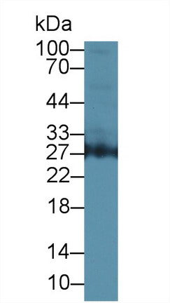 Polyclonal Antibody to Azurocidin (AZU)