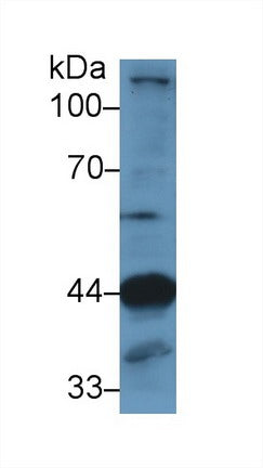 Polyclonal Antibody to Lysosomal Associated Membrane Protein 2 (LAMP2)