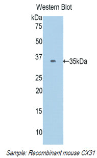 Polyclonal Antibody to Connexin 31 (CX31)
