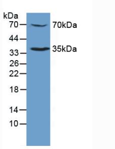 Polyclonal Antibody to Thrombopoietin Receptor (TPOR)
