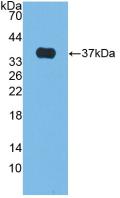 Polyclonal Antibody to Alkaline Phosphatase (ALP)