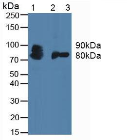 Polyclonal Antibody to Colony Stimulating Factor Receptor, Granulocyte (GCSFR)