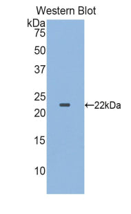 Polyclonal Antibody to Colony Stimulating Factor Receptor, Granulocyte (GCSFR)